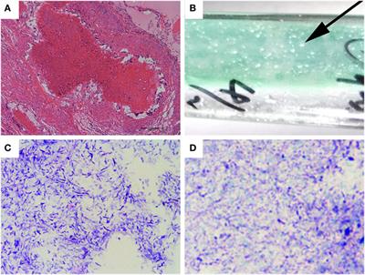 Isolation, Identification, and Characterization of a New Highly Pathogenic Field Isolate of Mycobacterium avium spp. avium